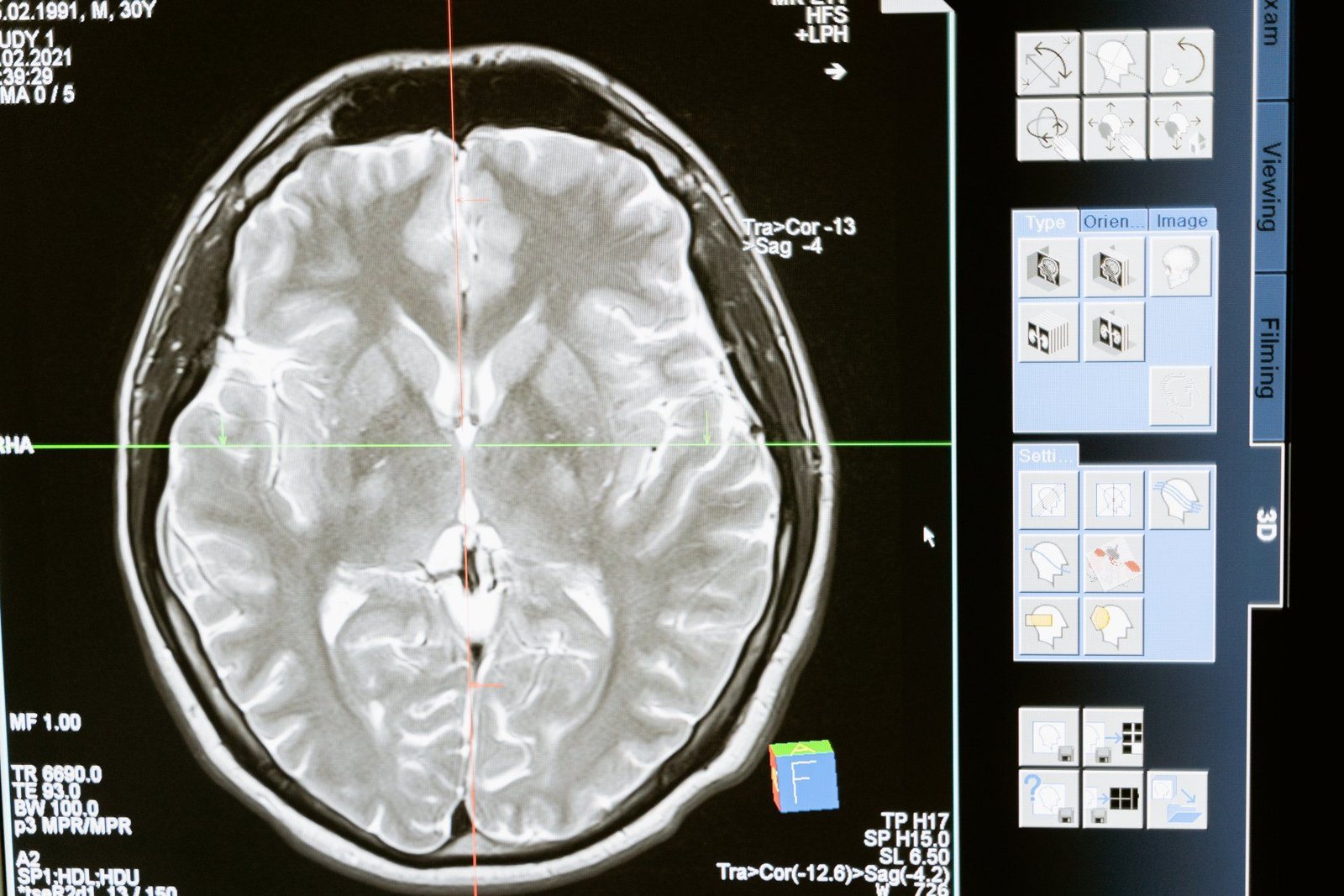 Why Antidepressants Aren’t Always Enough – The Rise of Integrative Psychiatry